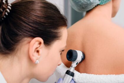 Common Skin Conditions Treated in Dermatology