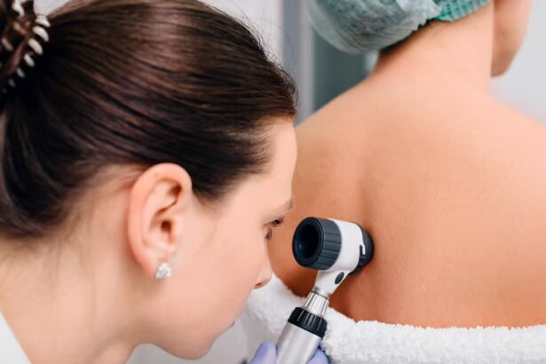 Common Skin Conditions Treated in Dermatology